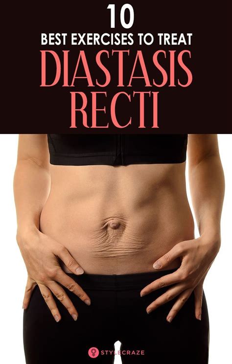 10 Best Diastasis Recti Exercises You Can Do At Home To Strengthen Your