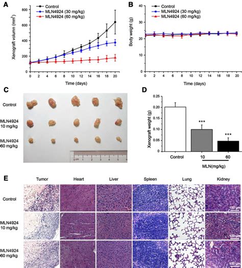 MLN4924 Suppresses The Growth Of In Vivo RCC Xenografts Model The