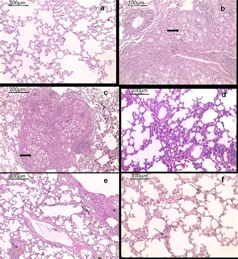 Histological Appearance Of Female Balbc Mice Lungs Tissue Hematoxylin