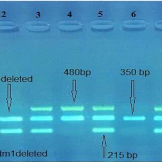 Electrophoresis Of Pcr Products On Agarose Gel Volt Hr