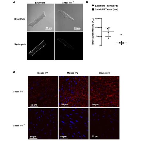 Syntrophin Staining In Wild Type And Knockdown Syntrophin