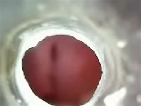 Inside My Urethra XVIDEOS