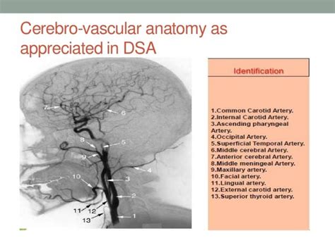 Cerebral Angiogram Anatomy - Anatomical Charts & Posters