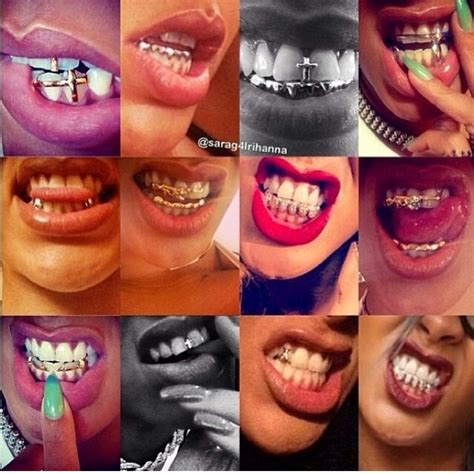 Pin by Something By Rae on Fashion: Rihanna | Grills teeth, Grillz ...