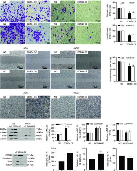 Ecrg Overexpression Inhibits The Metastasis And Invasion Of Gastric