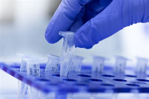 Cell Line Characterization