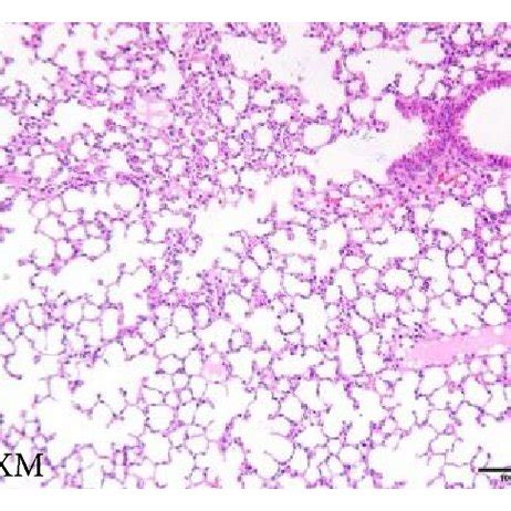 Effect Of Shl On Histopathological Change In Lung Tissues X H E