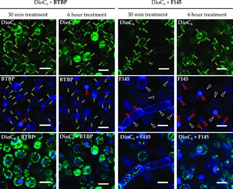 Clsm Of C Albicans Cells Treated With Dioc63 And F145 For Either 30 Download Scientific