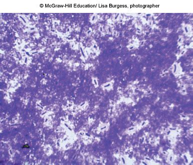 Microbiology Capsular Staining Study Flashcards Quizlet