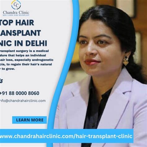 Stream Top Hair Transplant Clinic In Delhi Chandra Clinic By Chandra