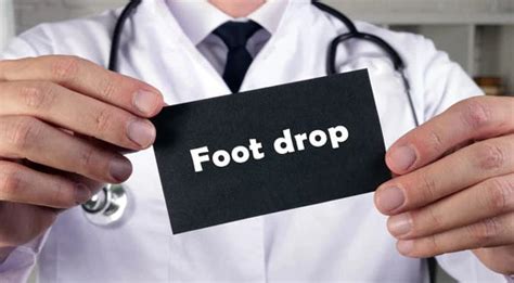 Foot Drop Causes Prevention And Treatment Drluigi