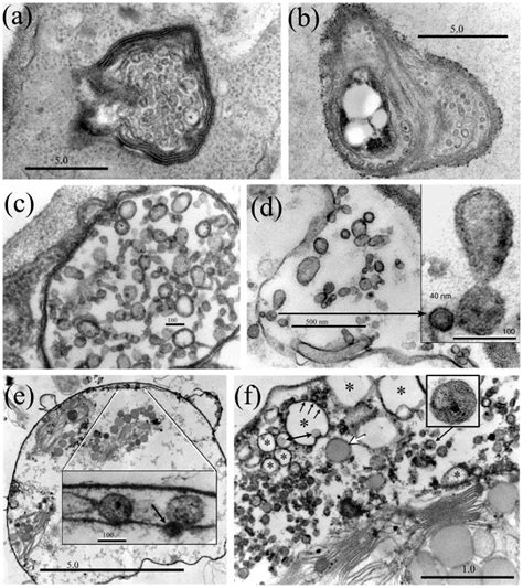 A Ms Vesicles Are Formed Within Multivesicular Bodies Mvb B