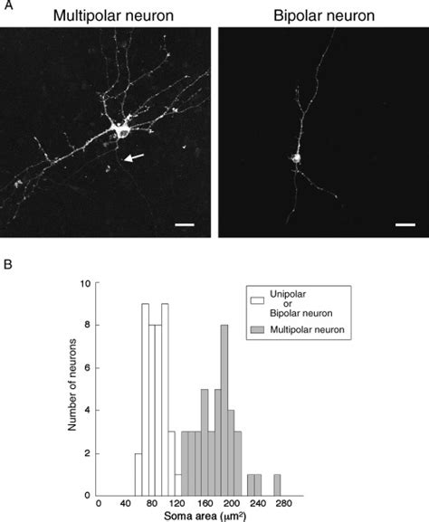 Somal Size Of Cultured Aob Neurons A Image Of Cultured Aob Neurons