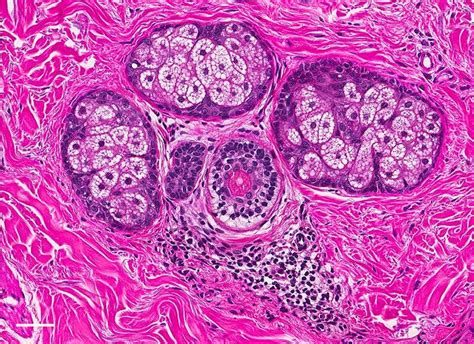 A Close Up Of Three Sebaceous Glands Surrounding A Hair Follicle The