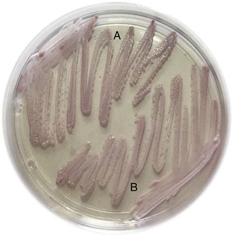 Appearance Of Yeast Colonies On Chromagar Candida Chromagar Company