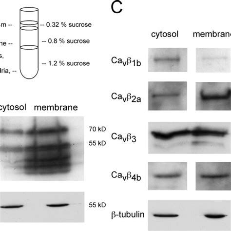 Endogenous distribution and expression of Cavβ subunits in cultured