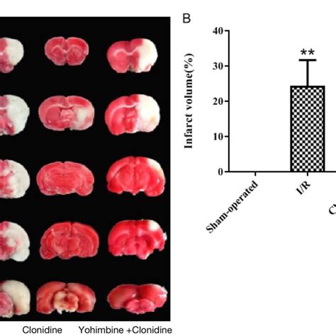 The morphology of neurons in the cortex and hippocampus of rats ... 
