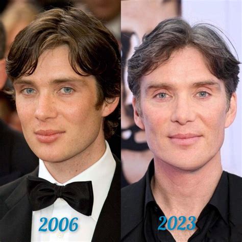 Cillian Murphy: Plastic Surgery Rumors Explored