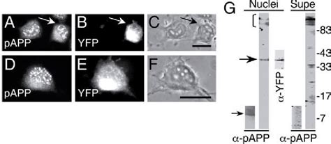 Intranuclear Anti PAPP Immunoreactivity Co Localizes With The Splicing