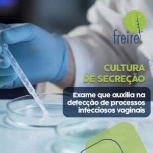 Como É Feito O Exame Cultura De Secreção - CULTURA DA SECREÇÃO | www.labfreire.com