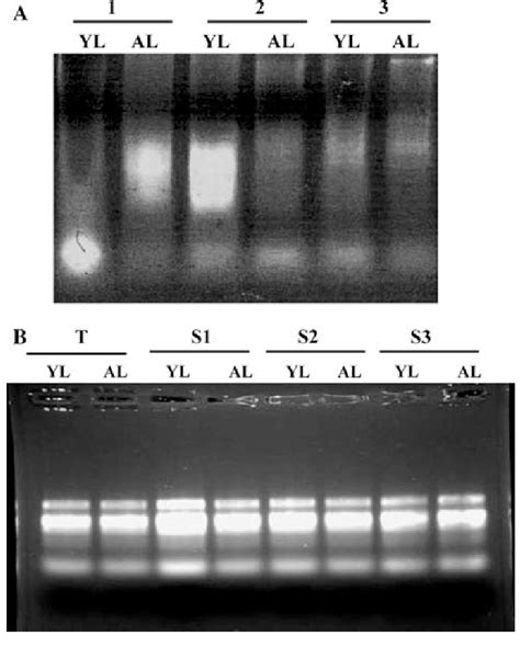 Agarose Gel Of Total Rna 5 Lg Isolated From Young Yl And Adult Al Download Scientific