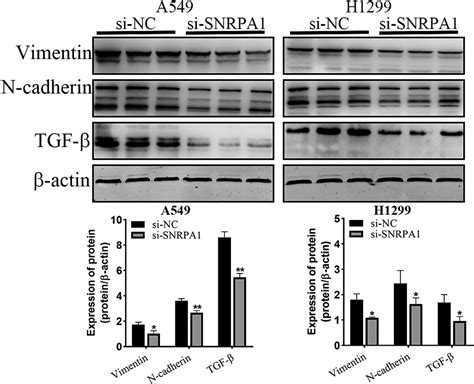 High Snrpa Expression Leads To Poor Prognosis In Patients With Lung