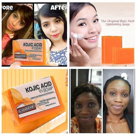 Kojic Acid Whitening Soap Dark Black Skin Lightening Soap Kojic Acid Glycerin Brighten Face Body