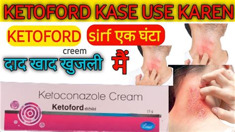 Ketoconazole Cream Is The Best Cream And Anti Fungal Infection Cream Anti Inflammatory Cream