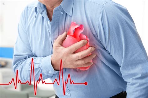 Factores De Riesgo De Las Enfermedades Cardiovasculares Top Doctors