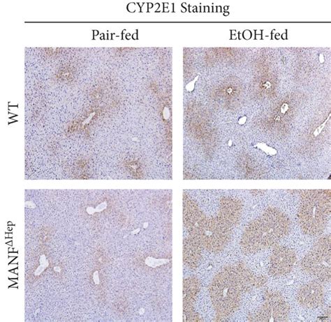 Hepatocyte Manf Deletion Activates Oxidative Stress In Alcohol Induced Download Scientific