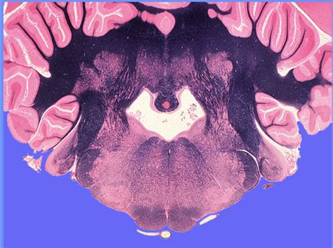 Vestibulospinal tract N. Diagram | Quizlet