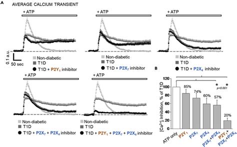 Effects Of P Receptor Inhibition On Ca I Handling In T D A