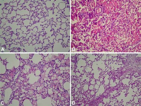 A Histological Examination Of Lung Tissue Of Group 1 Normal Pulmonary Download Scientific