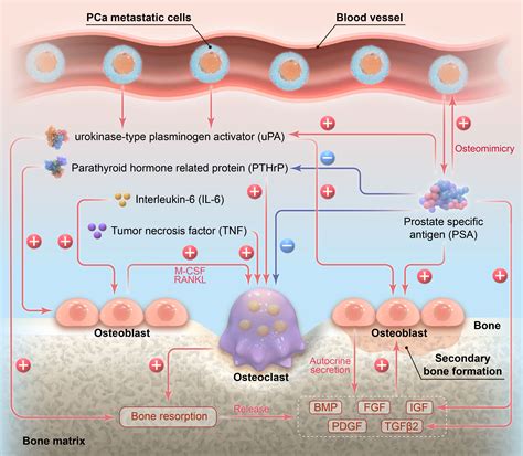 Frontiers The Role Of Prostate Specific Antigen In The Osteoblastic Bone Metastasis Of