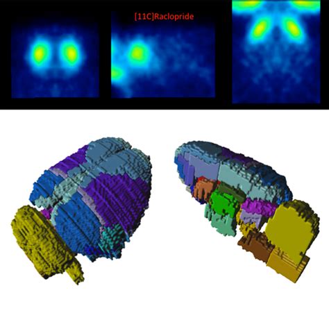 Volume Of Interest Voi Analysis Using Voi Atlas Files Voi Atlases