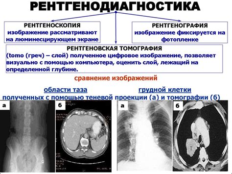 Рентгеновское излучение и его использование в медицине - презентация онлайн