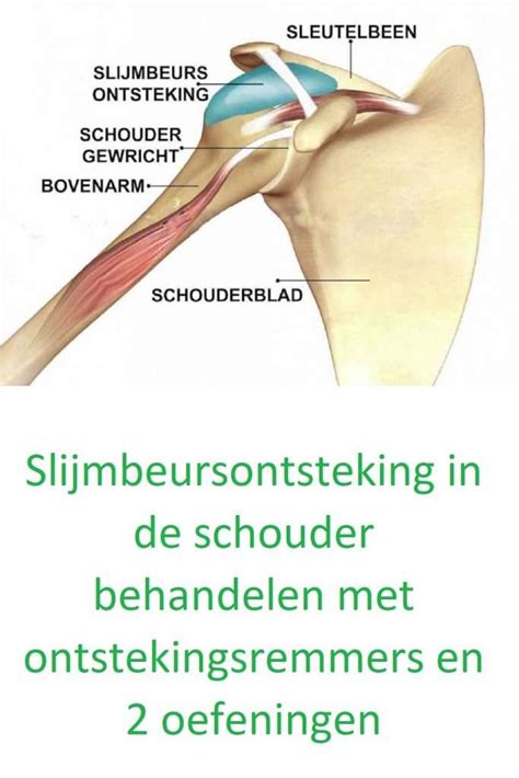 Slijmbeursontsteking In De Schouder Behandelen Met 2 Oefeningen