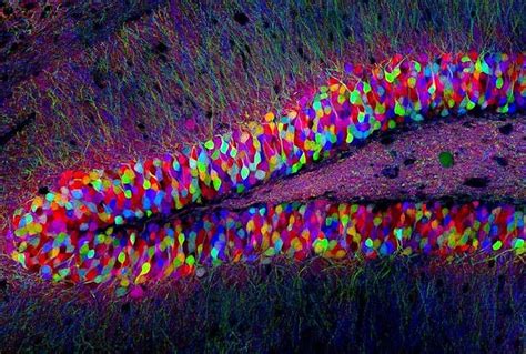 20 маленьких чудес с конкурса микрофотографии » BigPicture.ru