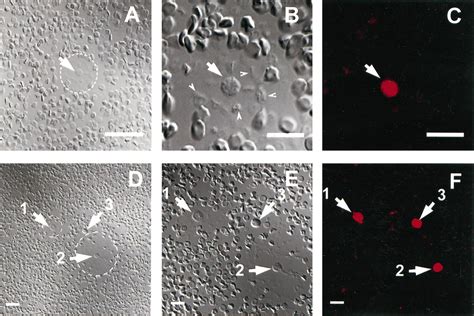 Hemolytic Plaques Formed By Anti Et Antibody Coupled Sheep Red Blood