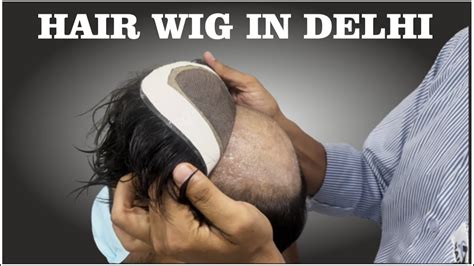 Hair Wig In Delhi Hair Patch In Delhi Hair Fixing In Delhi Hair Bonding In Delhi