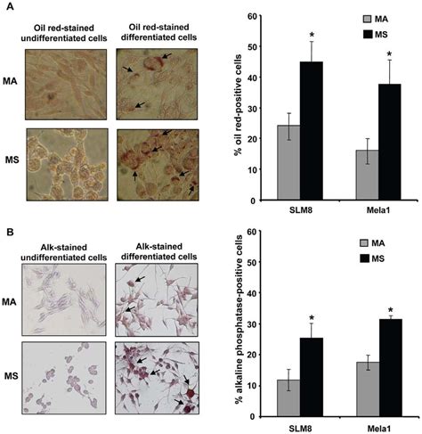 Melanoma Spheroid Cells Display Higher Capacity To Differentiate Along