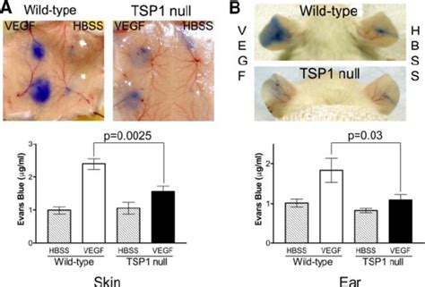 Vegf Induced Vascular Permeability In Wild Type And Tsp Null Mice