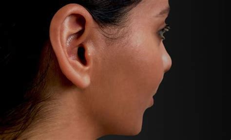 Ear Eczema Causes Symptoms And Treatment Options