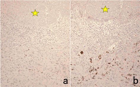 Figure 1 From Pitfalls And Caveats In Applying Chromogenic