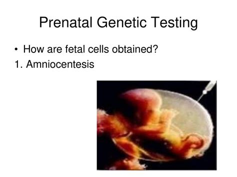 A Picture Of A Persons Chromosomes Ppt Download