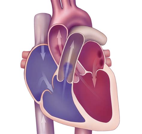 Aortic Stenosis YourTissueValve GB