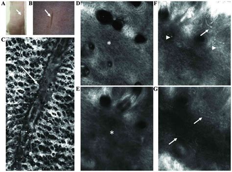 In Vivo Confocal Laser Scanning Microscopy Imaging Of Skin Inflammation