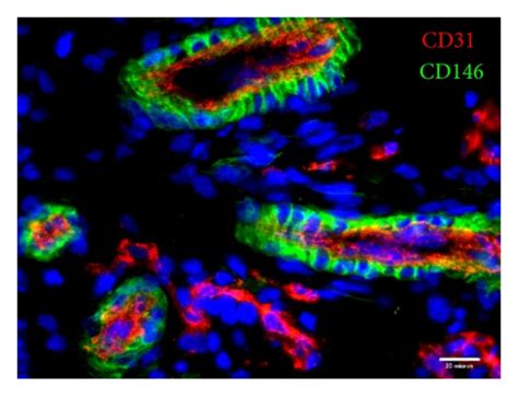 Resident Microvascular Pericytes In Human Myocardium Human Myocardium