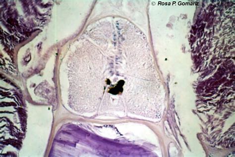 Bioimagen M Dula Espinal De Cefalocordado Autor Rosa