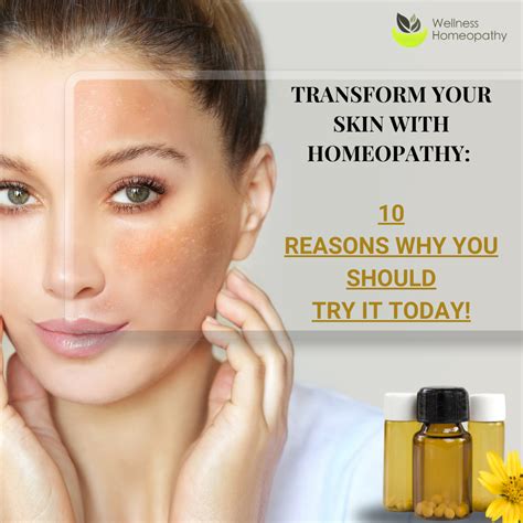 Transform Your Skin With Homeopathy 10 Reasons Why You Should Try It